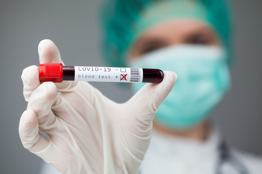 Helsepersonell med maske holder et reagensrør med blodprøve som viser positiv covid-19-test